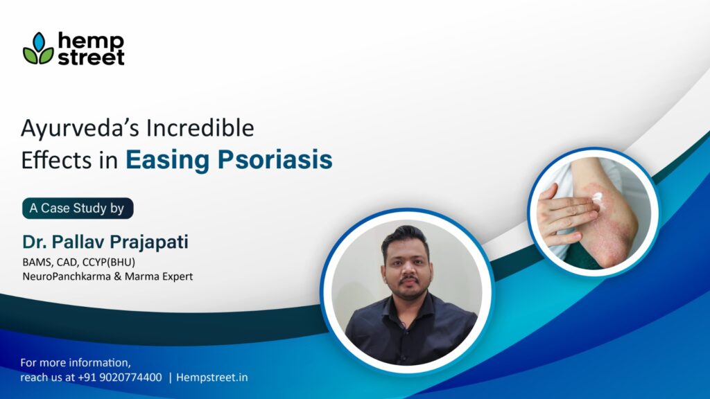 Ayurveda’s Incredible Effects in Easing Psoriasis